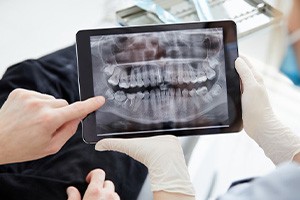 Dentist showing patient an X-ray of their teeth