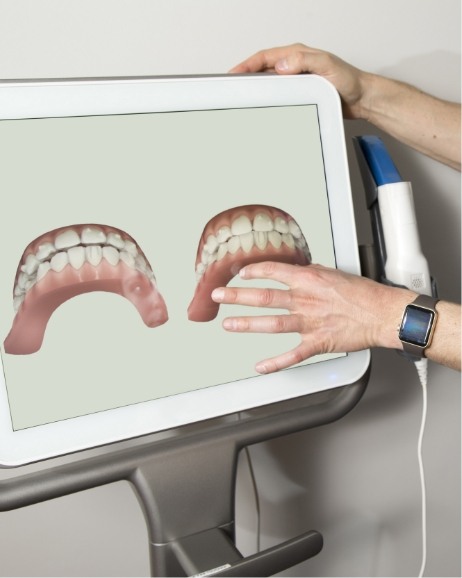 Dentist gesturing to computer monitor with digital images of teeth