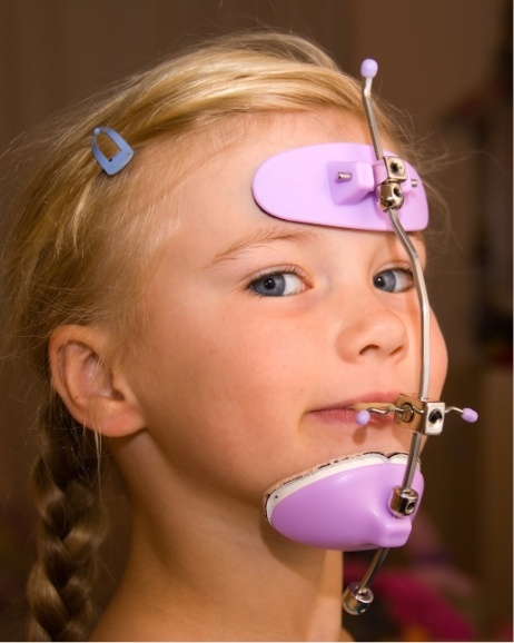 Young girl wearing orthodontic headgear