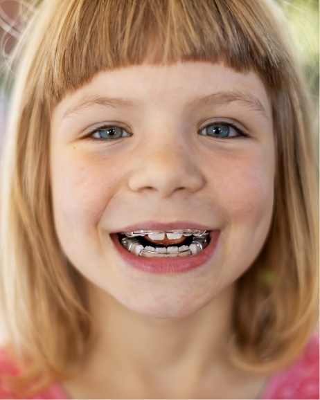 Smiling young girl with braces on both arches of teeth